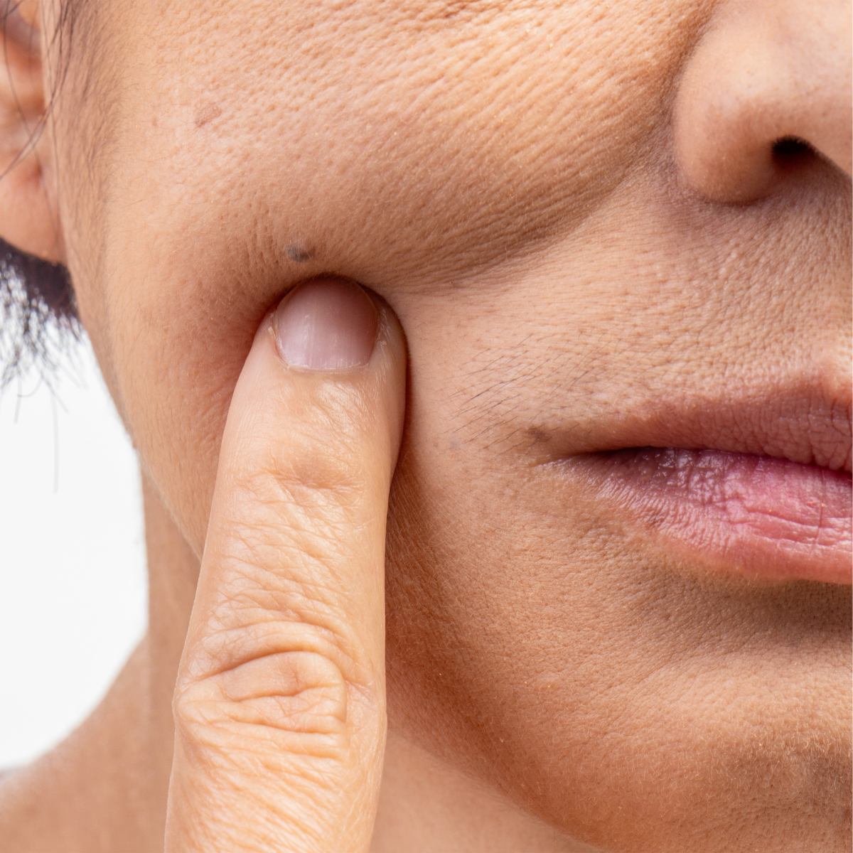 Dry vs Dehydrated Skin